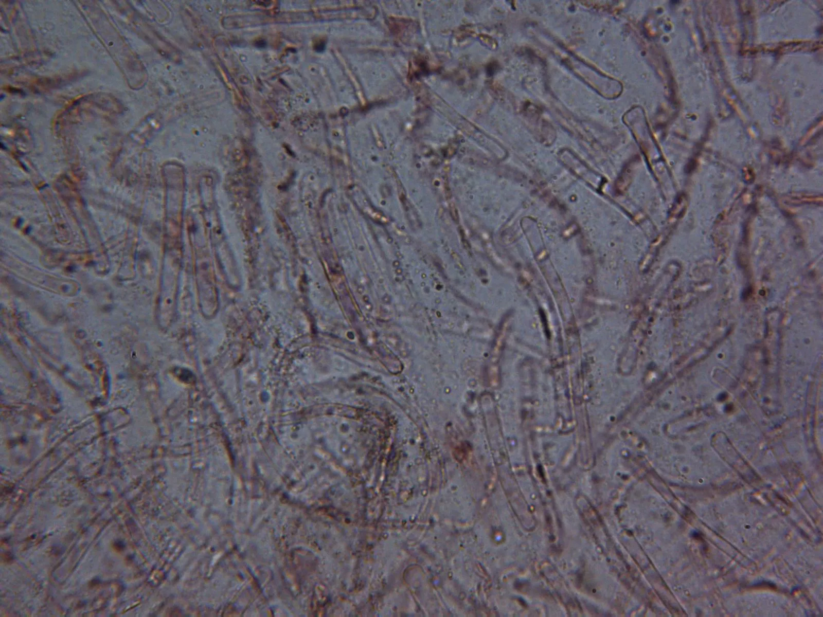 Microscopía de Suillus luteus - 10 - Suprapellis x 400 3